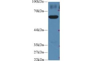 Image no. 2 for anti-Pyruvate Kinase M2 (PKM2) (AA 324-531) antibody (ABIN1860244)