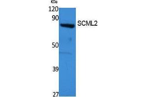 Image no. 1 for anti-Sex Comb On Midleg-Like 2 (SCML2) (Internal Region) antibody (ABIN3187657)