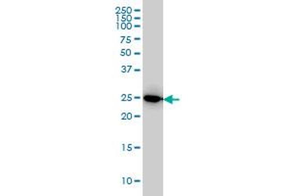 anti-Interleukin 27 (IL27) (AA 177-243) antibody