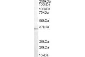 Image no. 1 for anti-Doublecortin-Like Kinase 1 (DCLK1) (C-Term) antibody (ABIN2789984)