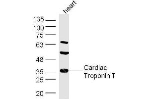 Image no. 2 for anti-Troponin T (Tn T) (AA 201-298) antibody (ABIN2179815)