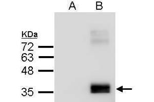 Image no. 3 for anti-Apolipoprotein E (APOE) (C-Term) antibody (ABIN2857040)