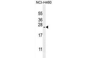 Image no. 2 for anti-ADP-Ribosylation Factor-Like 17A (ARL17A) (AA 109-139), (Middle Region) antibody (ABIN950501)