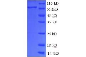Image no. 1 for Prostaglandin-Endoperoxide Synthase 2 (Prostaglandin G/H Synthase and Cyclooxygenase) (PTGS2) (AA 18-601), (partial) protein (His tag) (ABIN5710177)