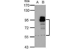 Image no. 3 for anti-phosphodiesterase 4D, cAMP-Specific (PDE4D) (C-Term) antibody (ABIN2855885)