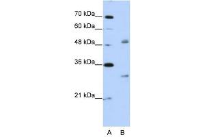 Image no. 2 for anti-Eukaryotic Translation Initiation Factor 4H (EIF4H) (Middle Region) antibody (ABIN629926)