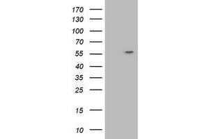 Image no. 1 for anti-ATPase, H+ Transporting, Lysosomal 56/58kDa, V1 Subunit B1 (ATP6V1B1) antibody (ABIN2716450)