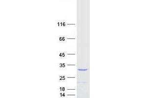 Image no. 1 for Tumor Necrosis Factor alpha (TNF alpha) protein (Myc-DYKDDDDK Tag) (ABIN2712390)