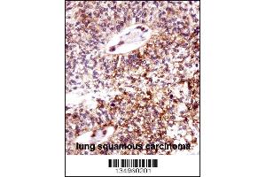 Immunohistochemistry (IHC) image for anti-Epithelial Cell Transforming Sequence 2 Oncogene (ECT2) (Center) antibody (ABIN2160796)