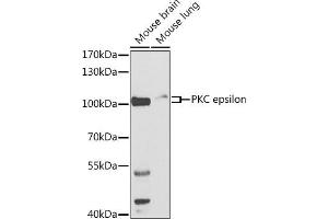 PKC epsilon Antikörper  (AA 488-737)