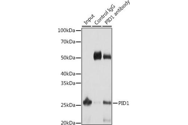 PID1 抗体  (AA 124-248)