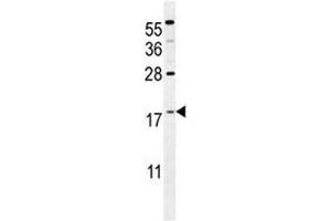 Image no. 3 for anti-S100 Calcium Binding Protein A4 (S100A4) (AA 1-30) antibody (ABIN3032512)