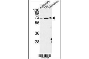 anti-Activating Transcription Factor 6 beta (ATF6B) (AA 560-589), (C-Term) antibody