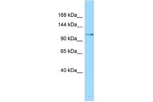 Image no. 1 for anti-Schlafen Family Member 5 (SLFN5) (N-Term) antibody (ABIN2790702)
