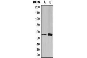 Image no. 1 for anti-Forkhead Box C1 (FOXC1) (Center) antibody (ABIN2706167)