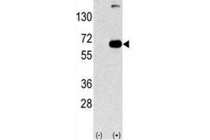 Image no. 8 for anti-Sequestosome 1 (SQSTM1) (AA 317-346) antibody (ABIN3031543)