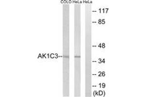 Image no. 1 for anti-Aldo-Keto Reductase Family 1, Member C3 (3-alpha Hydroxysteroid Dehydrogenase, Type II) (AKR1C3) (AA 191-240) antibody (ABIN1534617)