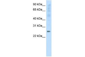 Image no. 1 for anti-Synaptosomal-Associated Protein, 25kDa (SNAP25) (C-Term) antibody (ABIN2792294)