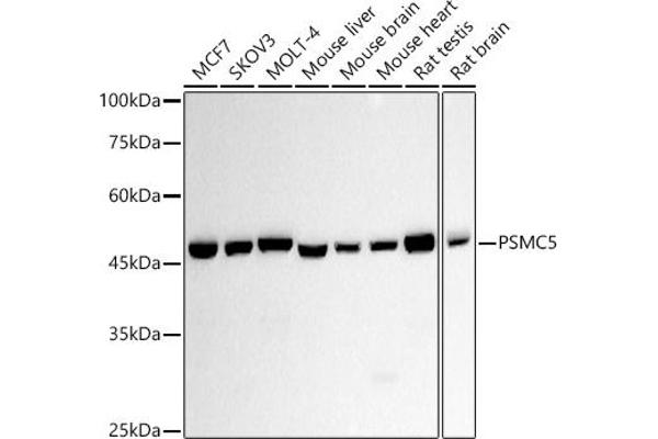 PSMC5 anticorps