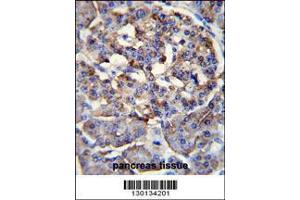 Image no. 2 for anti-Protein Phosphatase 1, Regulatory Subunit 37 (PPP1R37) (AA 36-64), (N-Term) antibody (ABIN655144)