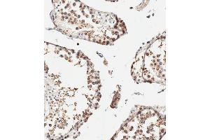 IFITM5 antibody  (AA 55-83)