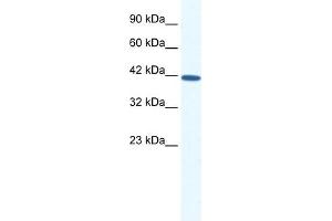 Image no. 1 for anti-SRY (Sex Determining Region Y)-Box 11 (SOX11) (N-Term) antibody (ABIN2777865)