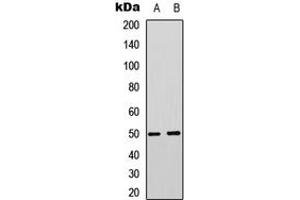Image no. 1 for anti-Solute Carrier Family 16 (Monocarboxylic Acid Transporters), Member 3 (SLC16A3) (Center) antibody (ABIN2706516)