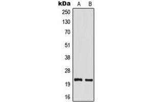 Image no. 1 for anti-TM2 Domain Containing 1 (TM2D1) (Center) antibody (ABIN2707184)