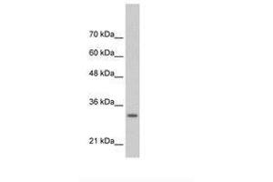 Image no. 2 for anti-Transcription Factor MafB (MAFB) (AA 41-90) antibody (ABIN6736309)