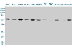 TUBA1 monoclonal antibody (M01A), clone 2E11.