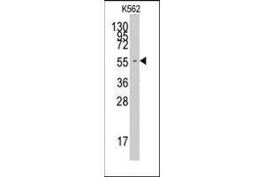 Image no. 2 for anti-Phenylalanyl-tRNA Synthetase, alpha Subunit (FARSA) (N-Term) antibody (ABIN359728)