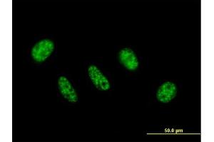 Immunofluorescence of purified MaxPab antibody to ZC3H11A on HeLa cell.
