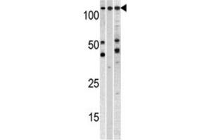 Western Blotting (WB) image for anti-Chromosome Segregation 1-Like (CSE1L) antibody (ABIN3000895)