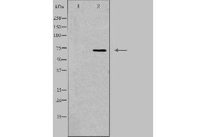 Image no. 2 for anti-Sodium Channel, Nonvoltage-Gated 1, delta (SCNN1D) (C-Term) antibody (ABIN6257772)