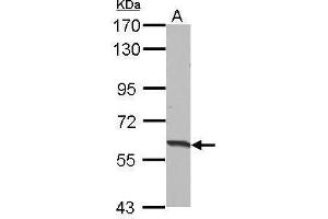 Image no. 1 for anti-Hyaluronan Binding Protein 2 (HABP2) (Center) antibody (ABIN2854555)