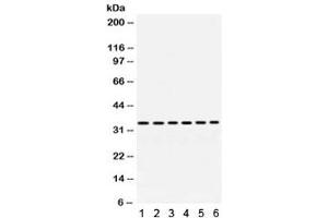 Image no. 3 for anti-Palmitoyl-Protein Thioesterase 1 (PPT1) antibody (ABIN4952244)