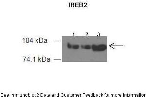 Image no. 2 for anti-Iron-Responsive Element Binding Protein 2 (IREB2) (Middle Region) antibody (ABIN2778884)