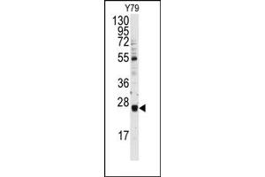 Image no. 1 for anti-Ubiquitin-Conjugating Enzyme E2E 3 (UBE2E3) (N-Term) antibody (ABIN357598)