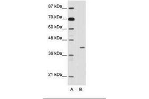 Image no. 1 for anti-Homeobox Containing 1 (HMBOX1) (N-Term) antibody (ABIN202481)