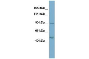 anti-Plakophilin 2 (PKP2) (N-Term) antibody