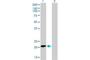 Image no. 3 for anti-Ras Homolog Gene Family, Member C (RHOC) (AA 1-193) antibody (ABIN513475)