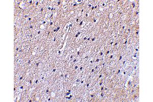 Immunohistochemistry (IHC) image for anti-Solute Carrier Family 9, Subfamily A (NHE1, Cation Proton Antiporter 1), Member 1 (SLC9A1) (Middle Region) antibody (ABIN1031013)