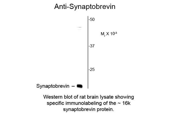 Synaptobrevin (VAMP) 抗体