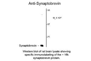 Image no. 1 for anti-Synaptobrevin (VAMP) antibody (ABIN6656054)