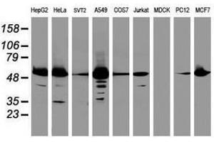EPHX1 antibody  (AA 21-230)