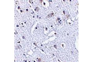 Image no. 2 for anti-TP53 induced glycolysis regulatory phosphatase (TIGAR) (Middle Region 2) antibody (ABIN1031205)
