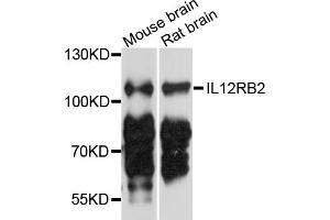 Image no. 2 for anti-Interleukin 12 Receptor, beta 2 (IL12RB2) antibody (ABIN4904030)