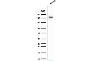 Image no. 6 for anti-Topoisomerase (DNA) II alpha 170kDa (TOP2A) (AA 1352-1493) antibody (ABIN6940773)