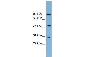Image no. 1 for anti-Nitrogen Permease Regulator-Like 2 (S. Cerevisiae) (NPRL2) (Middle Region) antibody (ABIN928385)