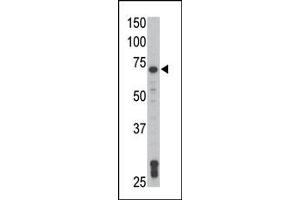 Image no. 2 for anti-TXK tyrosine Kinase (TXK) (N-Term) antibody (ABIN359999)